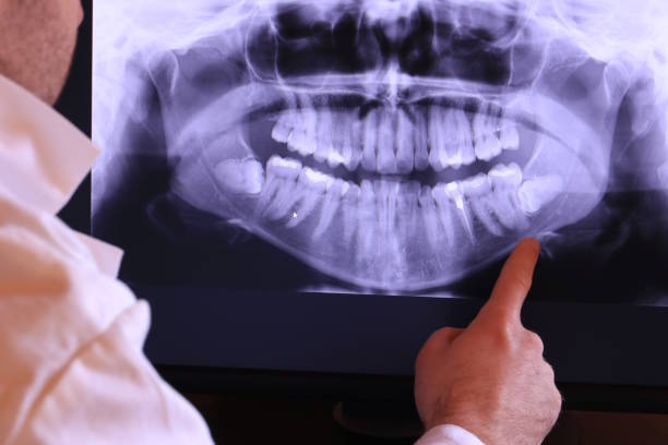 Best Emergency Dentist for Knocked-Out Tooth in Tonawanda, NY